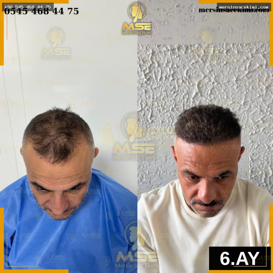 GÖKHAN SANCAR 6.AY
