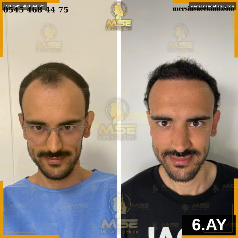 MEHEMT ÖZDEMİR 6.AY
